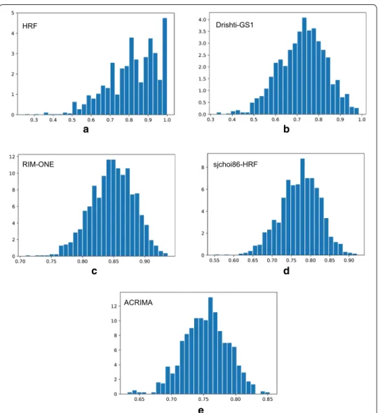 Fig. 10  Distribution of the AUC values per database. Histogram of the 1000 AUC values when evaluating the  Xception architecture using the bootstrapping technique