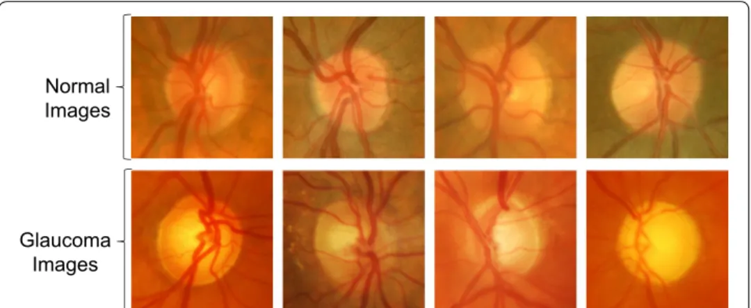 Fig. 3  Examples of the cropped fundus images. Cropped fundus images used for fine‑tuning and testing the  CNNs