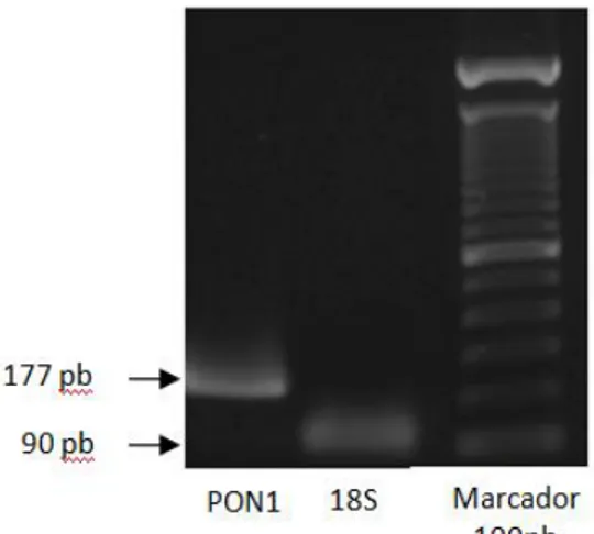 Figura 4: Comprobación de la amplificación de una banda única de los productos de PCR de la  PON1 y 18S en gel de agarosa