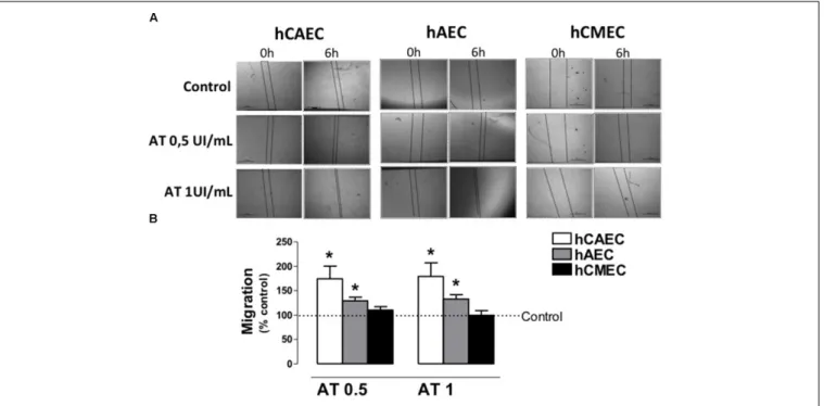 FIGURE 4 | Antithrombin activity on migration of human endothelial cells. (A) Representative images of hCAEC, hAEC and hCMEC with scratch wounds at 0 and 6 h of incubation with different concentrations of antithrombin 0 (control), 0.5 and 1 IU/mL