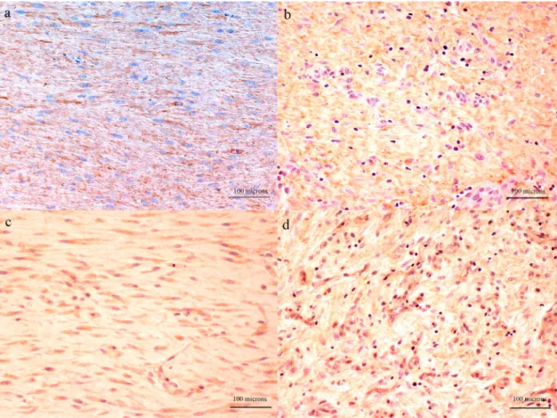 Figure 3. Representative histological sections immunostained for collagen types I (a and b) and III (c and d), from surgically severed Achilles tendons in sheep treated with PRGF (a and c) or saline solution (b and d).
