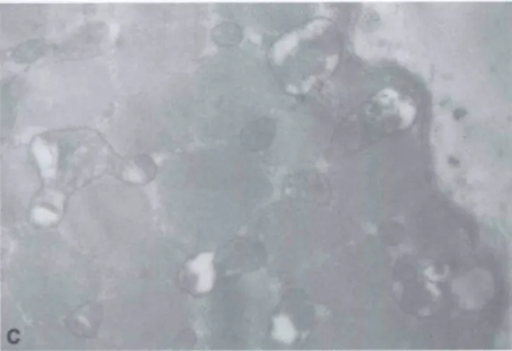 Fig. 3c. An electron photomicrograph in the uoii-imu stress group.