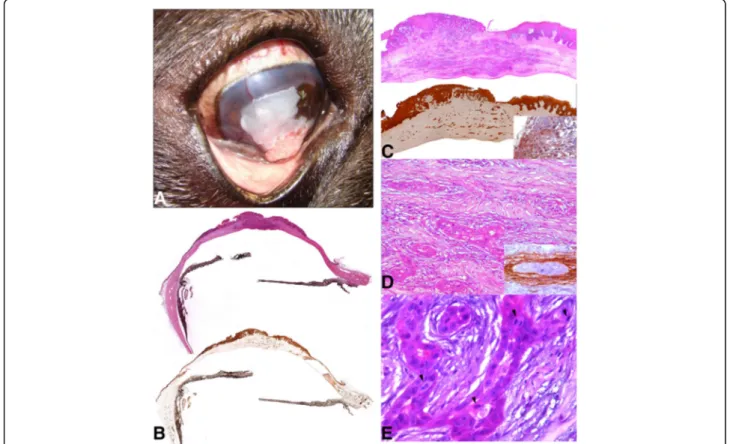 Fig. 1 a Exophytic white irregular mass occupying 70% of the central cornea. b and c Subgross photography of partial eye and cornea respectively (H-E and Cytokeratin)