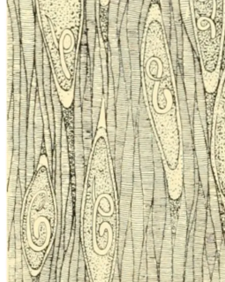 Figura 8. Esquema de quiste de Trichinella. 