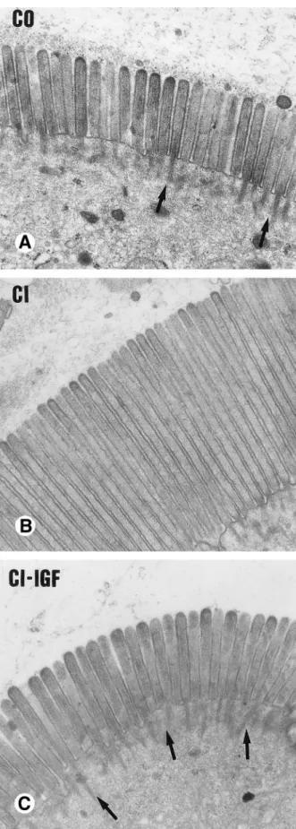 Figure 5. ( A – C ) Electron micrographs showing microvilli from jejunal tions, such as in hypoglycemia or hyperglycemia