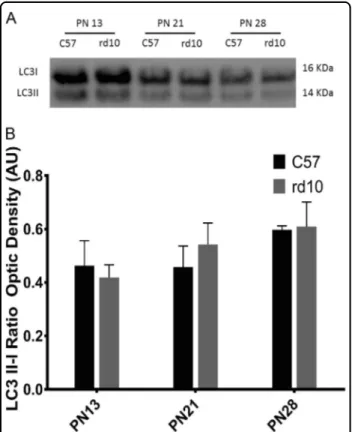 Fig. 4 Detection of the LC3 protein by western blot in the different age groups. a Image of the western-blot bands for both the control and rd10 at different ages