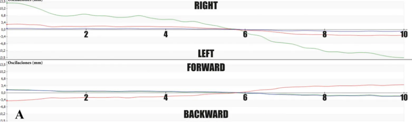 Fig 2. Stabilograms of Sound (A) and Lame (B) Dogs, Showing Oscillation of Body COP (Green Lines)