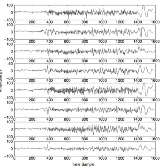 Fig. 2.3 Example of a multichannel EEG with the occurrence of a tonic- tonic-clonic (grand mal) seizure (adopted from [1])