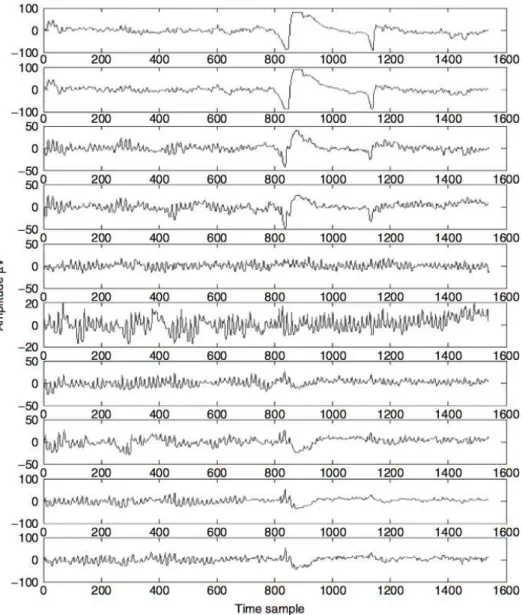 Fig. 2.5 Example of a multichannel EEG with the occurrence of an OA (adopted from [1])
