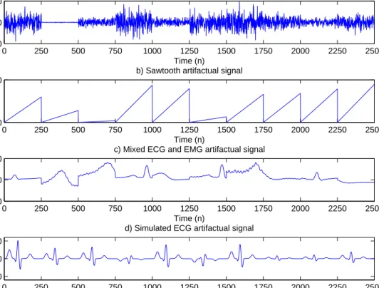 Fig. 5.4 Segment of artifactual signals with individual artifacts of length L = 250. a) White noise, b) Sawtooth, c) Mixed ECG and EMG, d)Simulated ECG