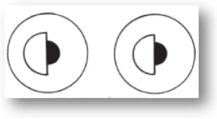 Figura 6: Hemianopsia temporal (8) 