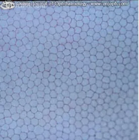 Figura 3. Endotelio corneal 8 . 
