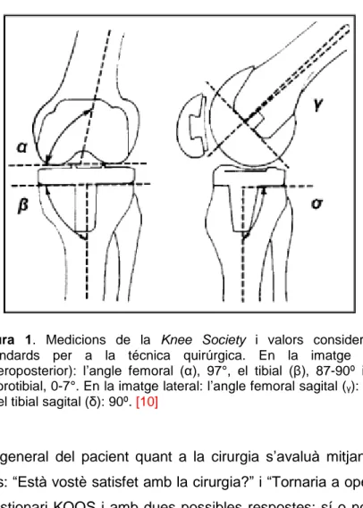 Figura  1.  Medicions  de  la  Knee  Society  i  valors  considerats  estàndards  per  a  la  técnica  quirúrgica