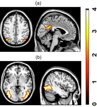 Figura 2. Activaciones cerebrales cuando comparamos bilingües frente a monolingües (a) y monolingües   frente a bilingües (b) en todas las condiciones de la tarea