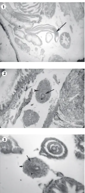 Fig. 1. Live S. mansoni parasite (arrow) with normal  development, between the organs of a susceptible snail