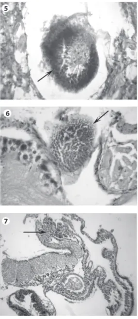 Fig. 4. Intense diffuse hemocyte infiltration at the  penetrating sites of miracidia (arrow) in a resistant snail