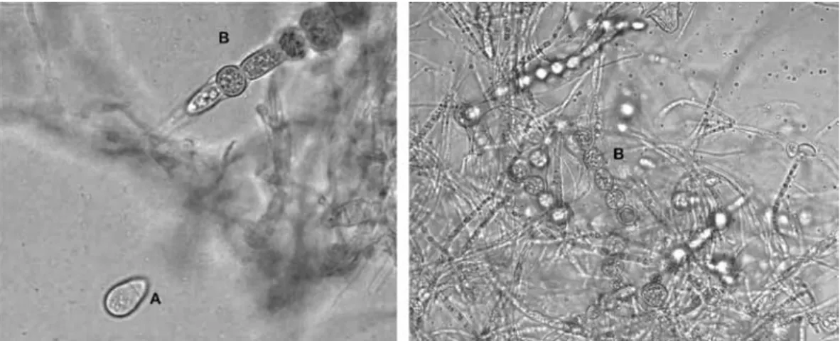 Fig. 3. (A) Conidia from Athrobotrys oligospora; (B) Chlamydospore chains formed by Arthrobotrys oligospora.