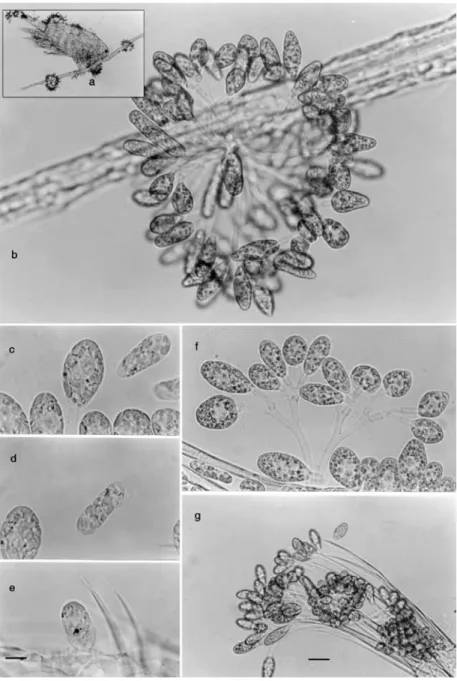 Fig. 3. (A) General aspect of Notodiaptomus spiniger infested by C. vesiculosum; (B) Colony of Colacium vesiculosum on the  first pair of antennae; C-E: View of a zooid (C) at the time of release from the colony (D) and moving (E) to fix on another  host; 