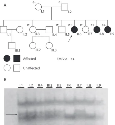 Fig. 1. Pedigree and SSCP analysis of the Costa Rican family with Becker disease. (A) Pedigree of the family affected by  Becker disease