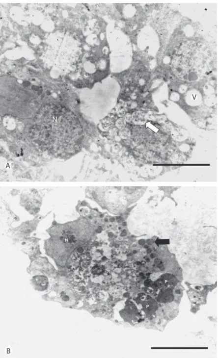 Fig.  5.  Electromicrografías  de  células  del  cultivo  celular  de  A.  aegypti.  (A)  Células  sin  infectar, presentando vacuolas vacías (v) y con material fibrilar (flecha blanca)