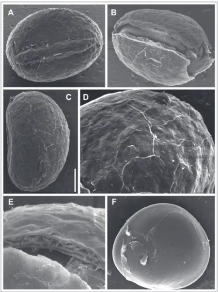 Fig.  4.  Spore  of  B.  sprucei. A:  Proximal  view,  with  rugulate  perispore  and  protruding    laesure