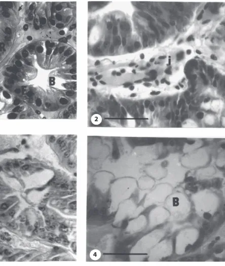 Fig. 1. Hepatopancreas of Palaemonetes argentinus from Canal 5. Note the different cell types in a non-pathological hepa- hepa-topancreas