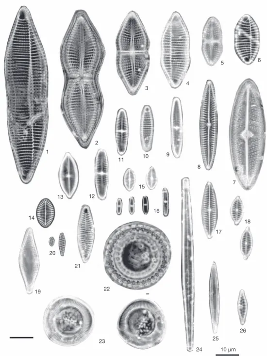 Fig.  5.  1-6)  Achnanthes  yaquinensis  McIntire  &amp;  Reimer,  7)  Trachyneis  velata  (A.Schmidt)  Cleve,  8)  Navicula  pennata  Schmidt, 9) Achnanthes pseudogroenlandica var