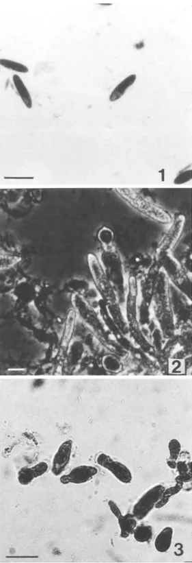 Fig. 1. Conidios primarios de Zoophthora radicans a partir  de larvas de Tuta absoluta