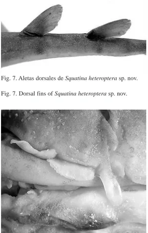 Fig. 7. Dorsal fins of Squatina heteroptera sp. nov.