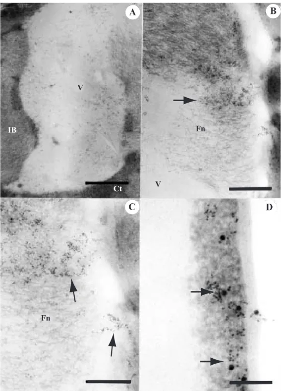 Fig. 4. Transmission electron micrograph of cross sections from RHBV-infected rice leaf tissue cells (A and B).