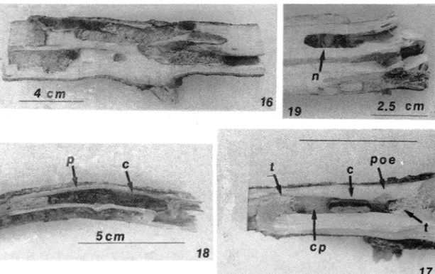 Fig.  16.  Capullo  pupal  (c)  con  orificio  de  emergencia  del  adulto  de  Bracon  sp