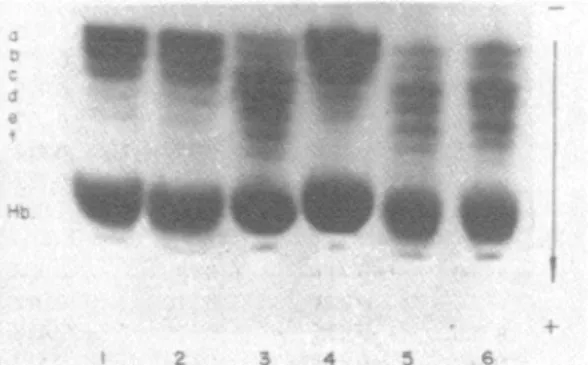Figure 1 .  Electrophoretic pattems oí me TPI  1.1  (nonnal),  lanes 1 ,2 and 4, and  TPl 1 ,  3 BR!,  la.nes 3, 5 and 6  alter  a  PAGE  (7% acrylamide , pH 8.5)