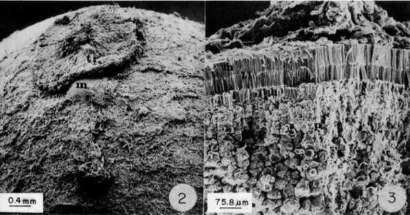 Fig. 2.  Vista  de  la  zona hilar -micropilar  de  la  semilla.  tr,  tapón  de resina  sólida que  cubre  el hilo;  m,  micropilo