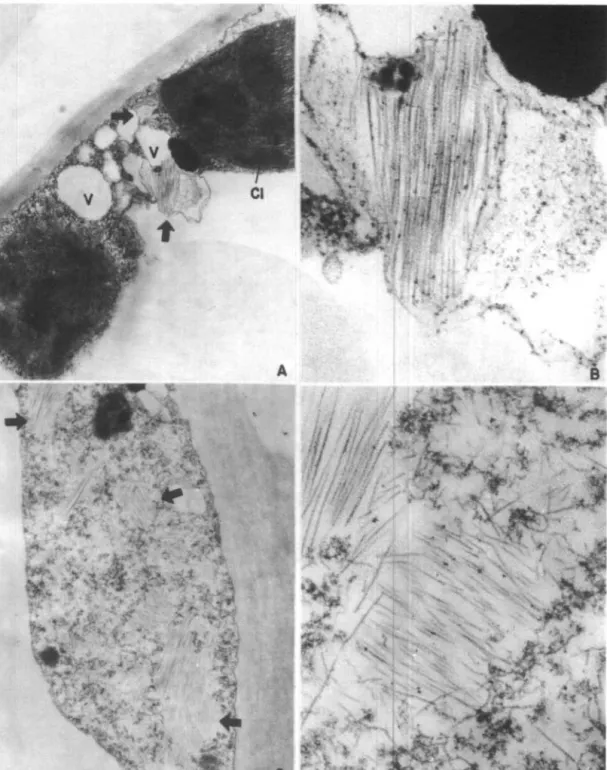 Fig.  4.  Cortes  u lt rafinos de  hojas  lesionadas  con  inclusiones del  virus rígido
