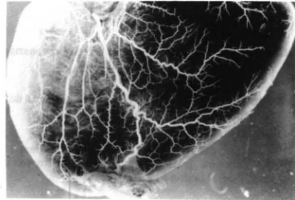 Fig.  1 7.  Superficie  dorsal  del corazón  diafanizado  de  tortuga  marina  (Chelonia  mydos)  mostrando  las  rami­