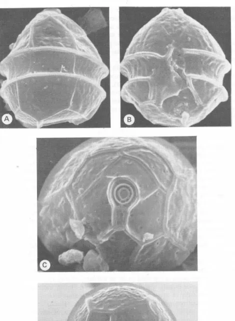 Fig.  1.  Peridinium  incosvicuum 