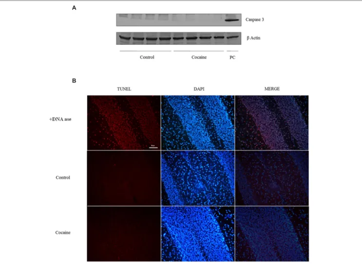 FIGURE 5 | Caspase-3 (17/19 kDa) and β-Actin (42 kDa) western blot analysis in cerebellum (A; Ba/F3 cells were used as positive control of caspase 3 activation)