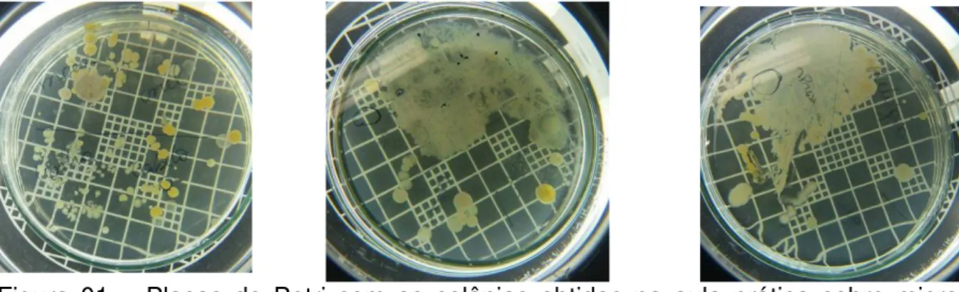 Figura  01  ±  Placas  de  Petri  com  as  colônias  obtidas  na  aula  prática  sobre  micro- micro-organismos no ambiente