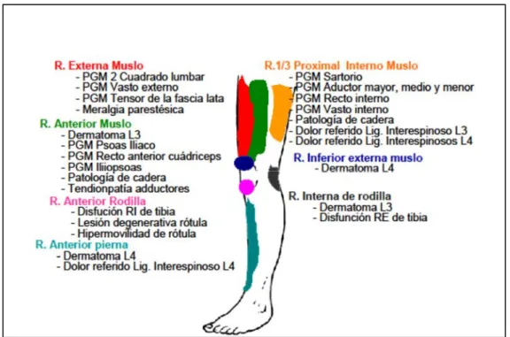 Figura 3. Patrones de dolor referido por PGMs y otros patrones de dolor habituales en miembro  inferior