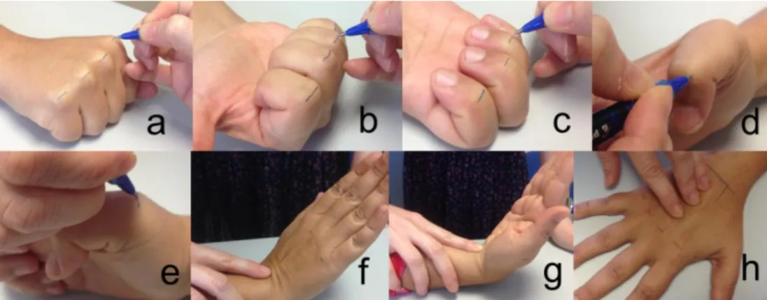 Figure 1. Marking limits of phalanges and metacarpals: from a) to e) limits of  phalanges; f) and g) limits of hand (metacarpals with the wrist); h) limit of each  metacarpal (direction)