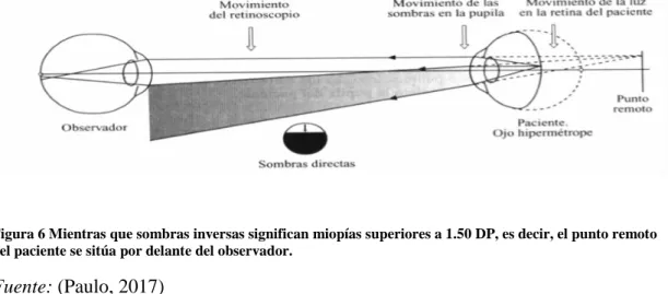 Figura 5 Sombras Directas. 