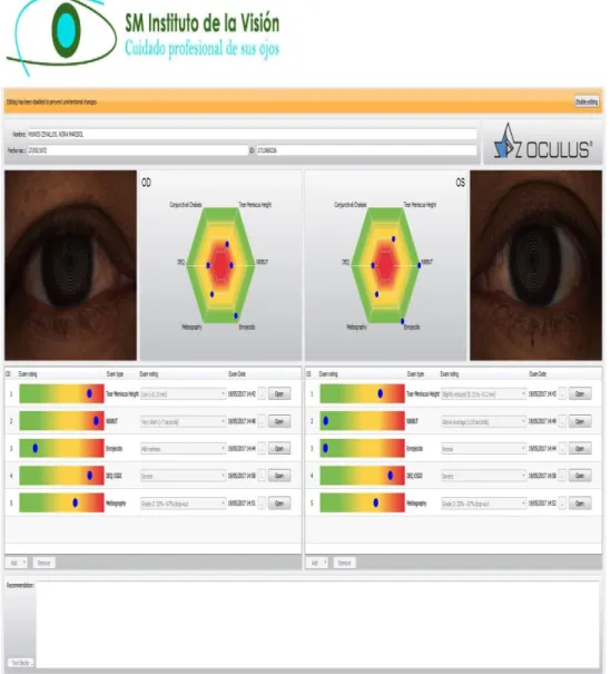 Figura 11 Reporte Jenvis  Fuente: (Oculus) 