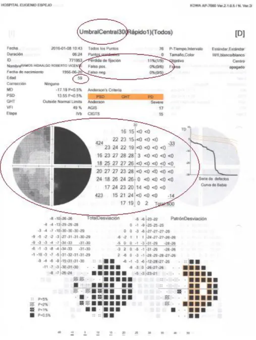 Figura 8: En la siguiente imagen se observa el examen campimétrico, resaltando los parámetros que se va a  tomar en cuenta para el estudio de Investigación  