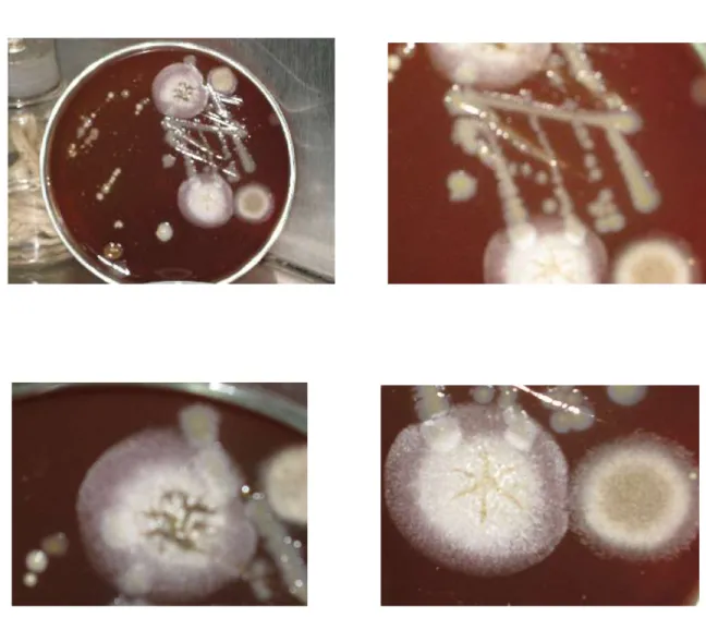 Fig. 1.  a) Se observan 4 colonias diferentes, b)  crecimiento de una cepa hemolítica, c y d) cepas  blanco-amarillenta