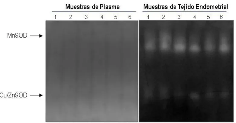 Figura 3: Actividad Superóxido dismutasa en muestras de Plasma y Tejido endometrial