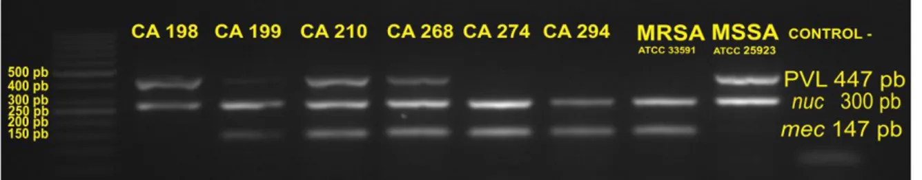 Figura 4. PCR múltiple para la detección de los genes nuc, mecA y lukF-PV