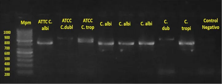 Figura  7.  Gel  de  agarosa  al  2%  con  bromuro  de  etidio,  donde  se  muestra  los  productos  obtenidos  para  PCR  multiplex    los    ADN  de  Candida  spp.