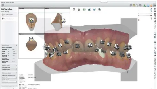 Figura 3. Software Orthoanalyzer de 3Shape. 