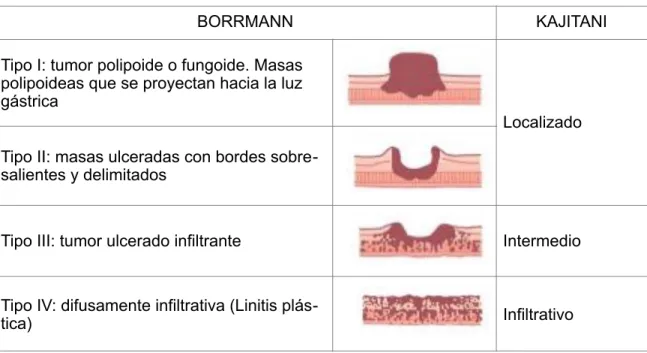 Cuadro 1. Clasificación endoscópica del cáncer gástrico avanzado 