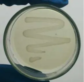 Figura 10. Crecimiento bacteriano del Enterococcus faecalis (ATCC 29212  ®™). 